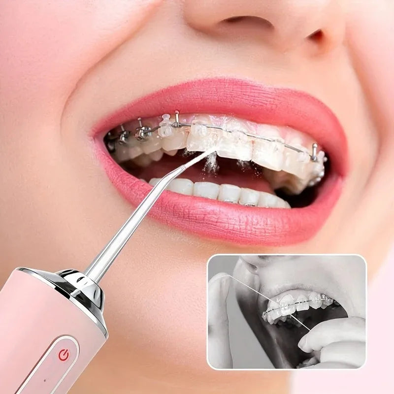 Portable Electric Water Flosser — Rechargeable Oral Irrigator for Teeth, Gums & Braces